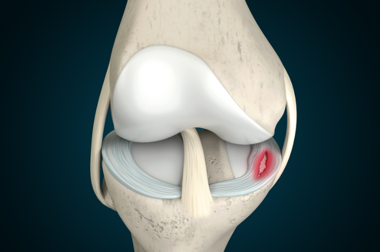 orthobiologics